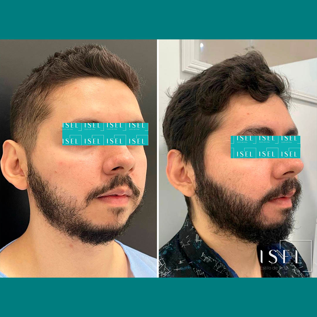 Tratamiento para Crecimiento de Cejas Reelance en Gel – CAPITÁN BARBAS®